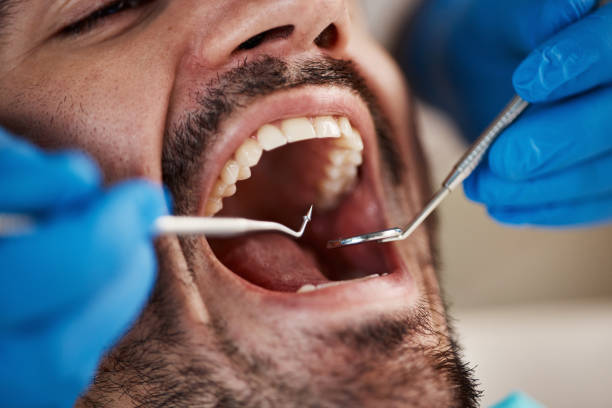 Best Mobile Emergency Dentist in Fullerton, PA